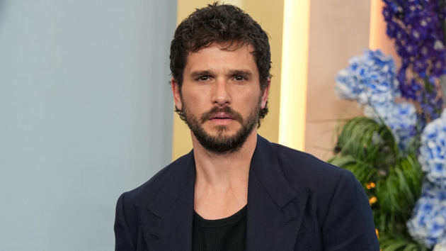 Kit Harington replaces Nicholas Hoult as Gilderoy Lockhart in ‘Harry Potter’ series
